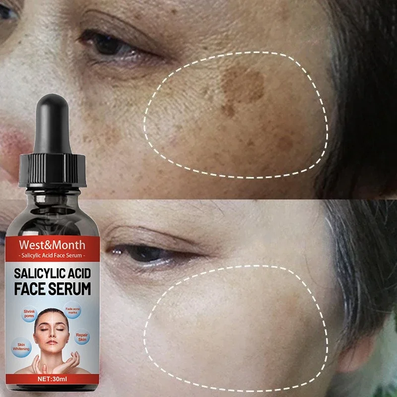 

Nicotinamide Attenuates Stains Facial Serum Salicylic Acid Shrinks Pores Freckle Removal Moisturizes Face Skin Care Products