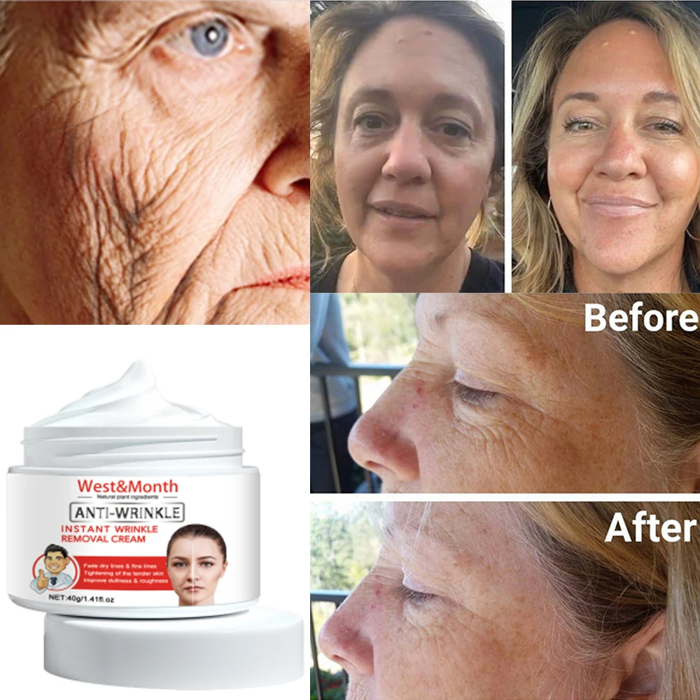 West&Month Retinol Lifting Firming Cream Women\'s Fine Line Dark Circle Remover Moisturizing essence Eye Mask Cream