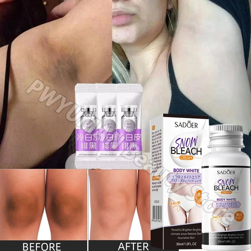 Whitening Cream Private Parts Underarm Inner Thigh Elbows Brighten Remove Melanin
