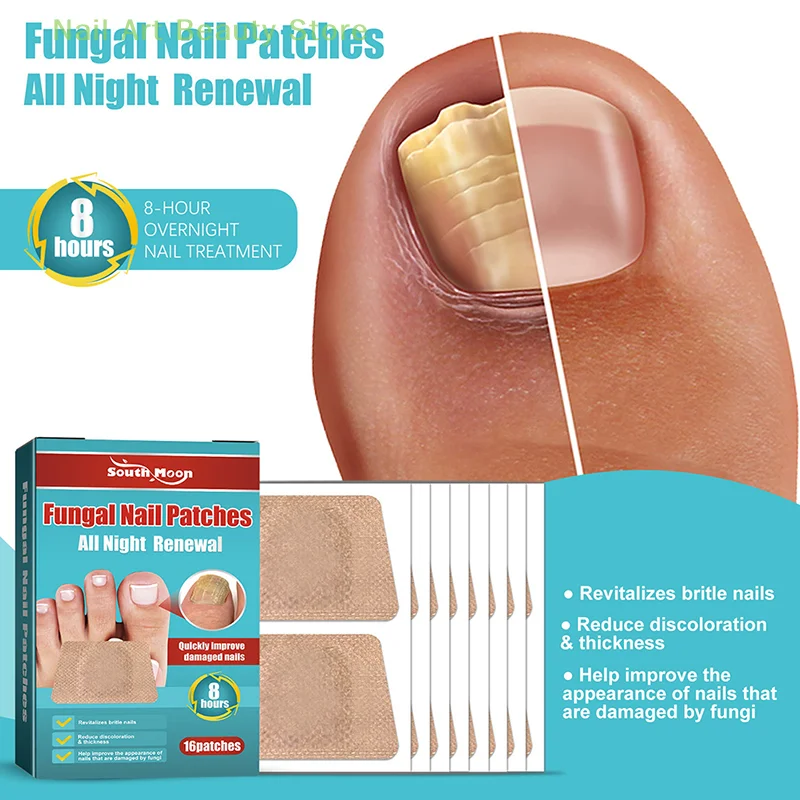 

16Pcs Nail Treatment Patch Anti Fungal Nail Correction Stickers Ingrown Toenail Care Paronychia Anti Infection Repair Patch