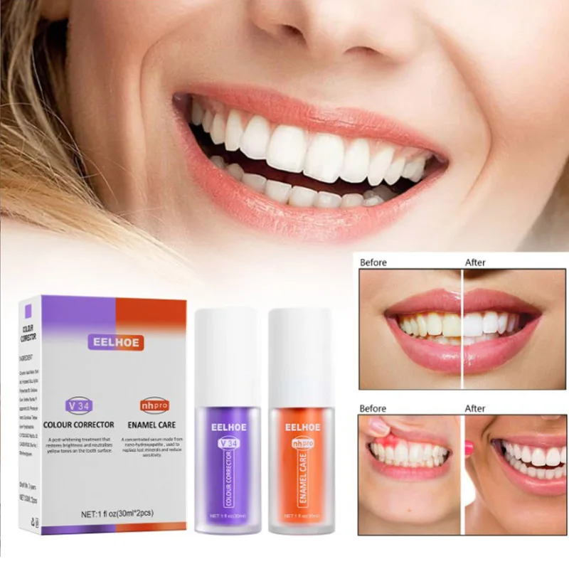 V34 Teeth Whitening Toothpaste Intensive Stain Removal Reduce Yellowing