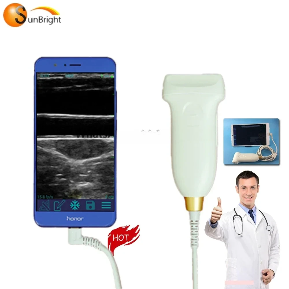 Portable 7.5Mhz USB linear probe ultrasound transducer best price USB ultrasound probe