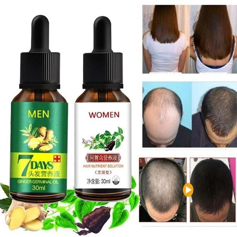 Fast Hair Growth Set Biotin Ginger Essential Anit Hair Loss Thickener Serum  Shampoo And Conditioner Kit for Men Women| | - AliExpress