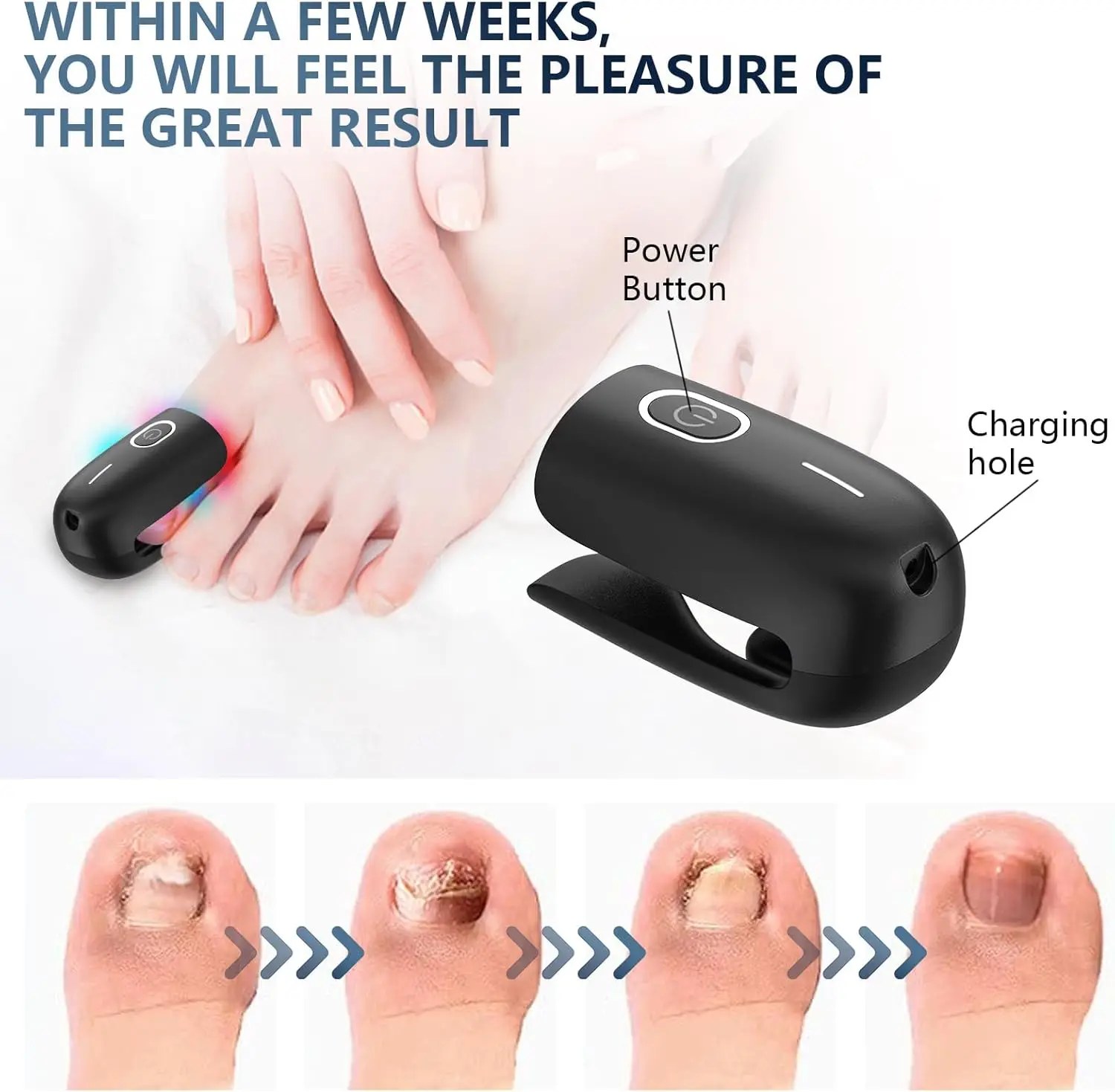Nagelpilz-Lasergerät mit 470 nm Blaulicht, 660 nm Rotlicht und 905 nm Superpuls-Licht zur intelligenten Entfernung und Reparatur von Nagelpilz._voghion.com