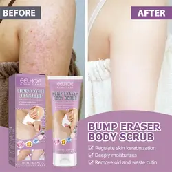 Body Scrub Cream Moisturizing Skin Repair Keratosis Pilaris Removing Strawberry Legs Eraser Nourishing Body Skin Care Products