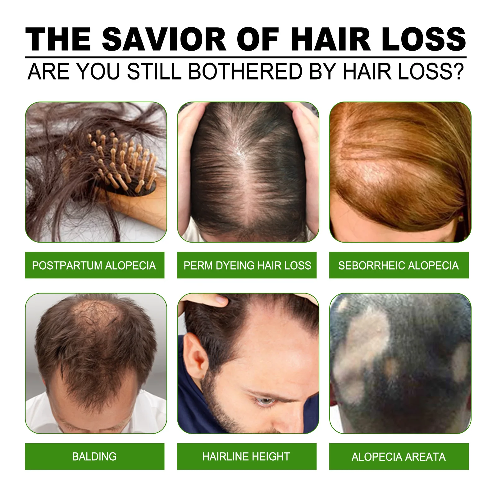Hair Growth Oil Nourish Serum Prevent Loss Improves Dry Scalp T-reatment Reduce Damage Increase Hairline Hair Care Essential Oil