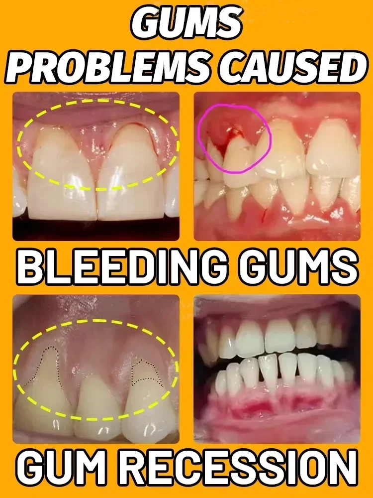 Gum Repair Drops Rapid Repair Gums Serum Effectively Relieve Tooth Allergy Dental Caries Tooth Cleaning Toothpaste Relieve Damage Drops