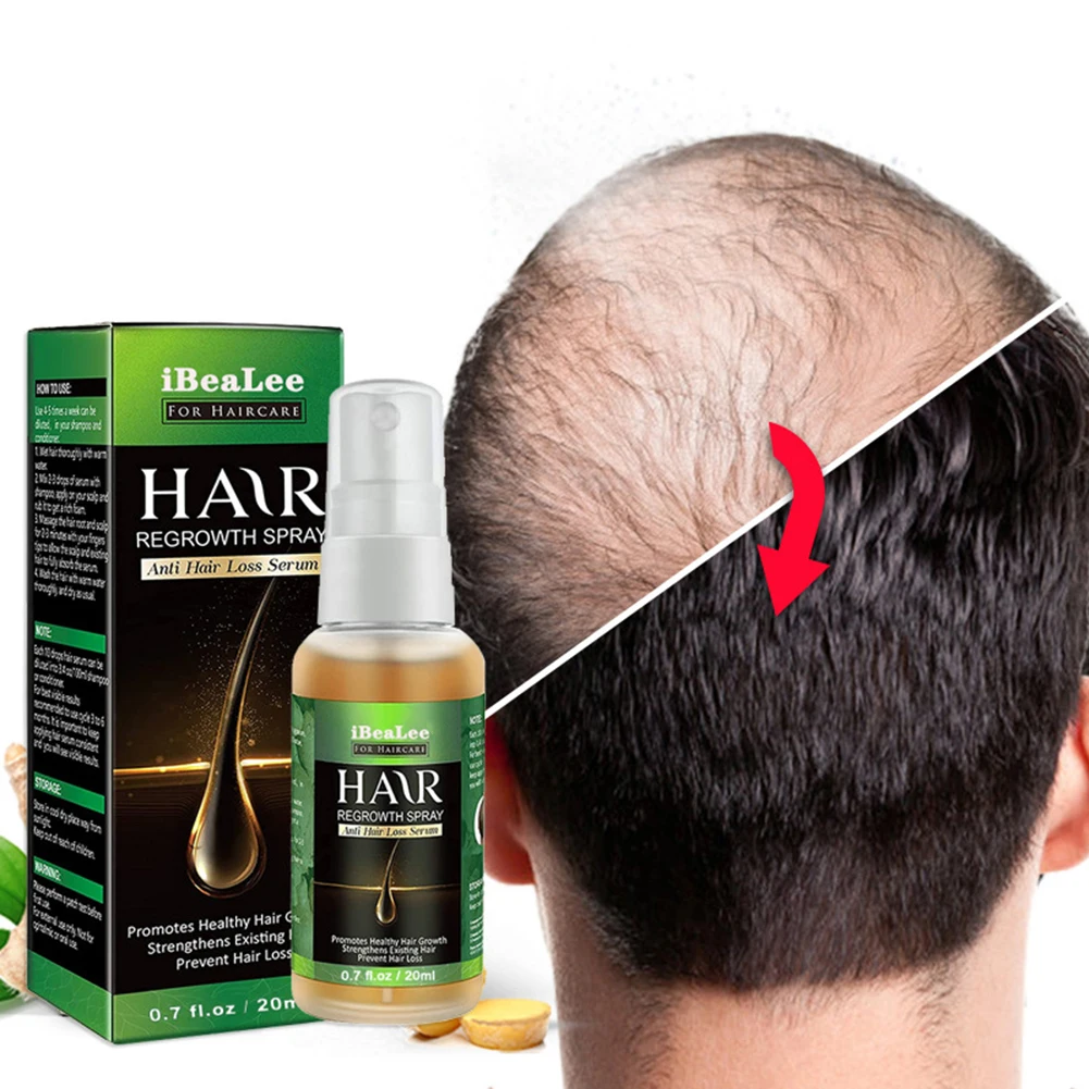 Ginger Hair Growth Essential Oil Hair Treatment Anti Lost Beauty Product hair growth oil hair restoration products