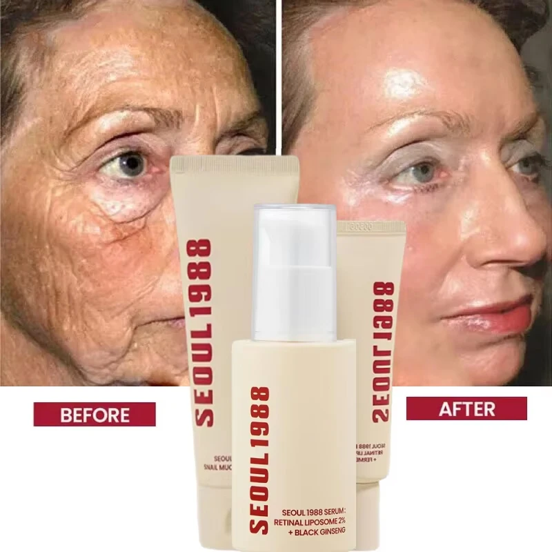 الكورية 1988 ريتينول مصل العناية بالوجه الجينسنغ ا...