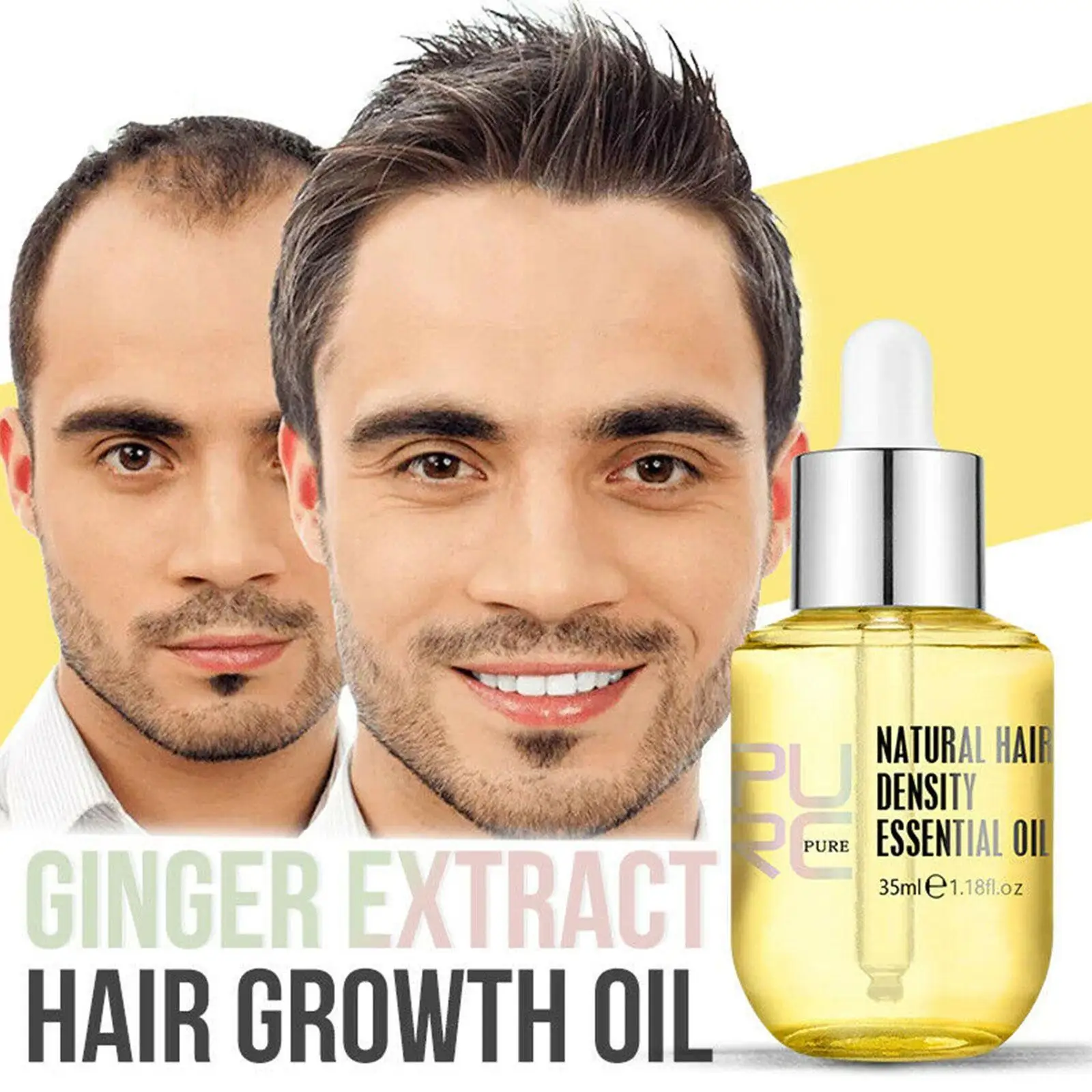 PURC 35ml Ginger Essence Oil Men Women Hair Loss Thinning Treatment Liquid Fast Regrowth Hair Density Essential Oil hair growth serum hair growth spray hair growth cream
