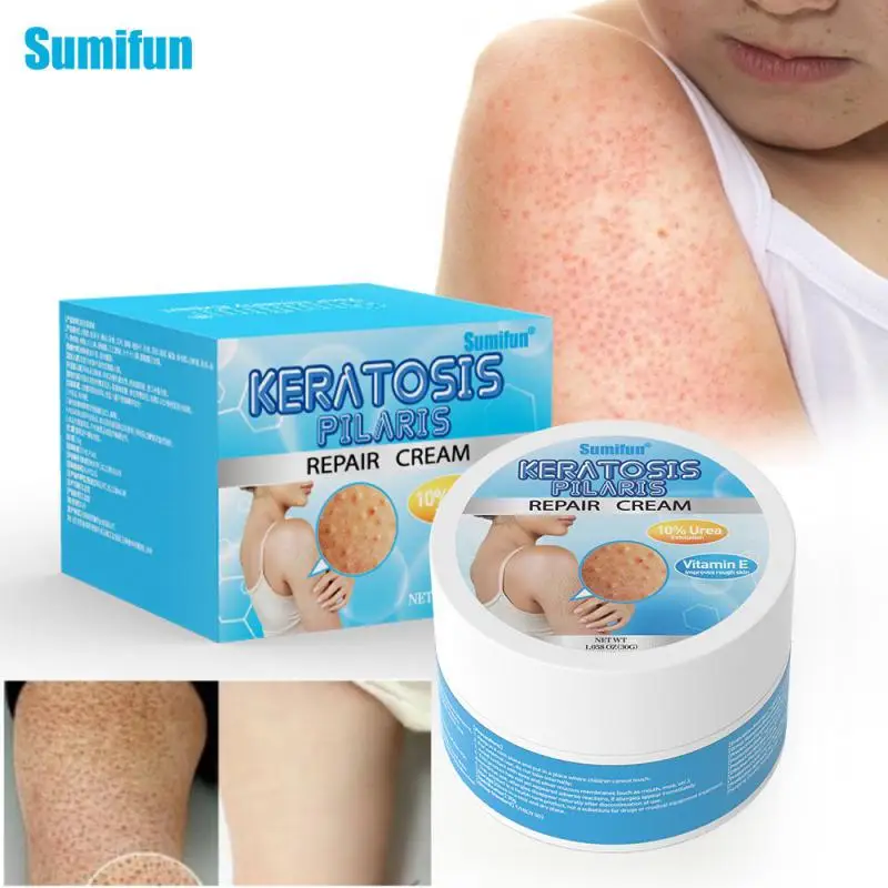 VitaminEStrawberryLegsRemovalBodyScrubChickenSkinCreamUrea