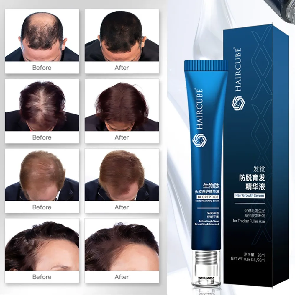 

Hair Growth Serum Fast Regrow Hair Line Anti Hair Loss Essence Nourish Promote Hair Growth Hair Care Product For men 60g