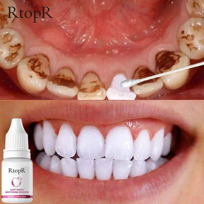 

RtopR Teeth Whitening Serum Remove Plaque Stains Essence Oral Hygiene Cleaning Bleaching Gel Fresh Bad Breath Dental Care Tools