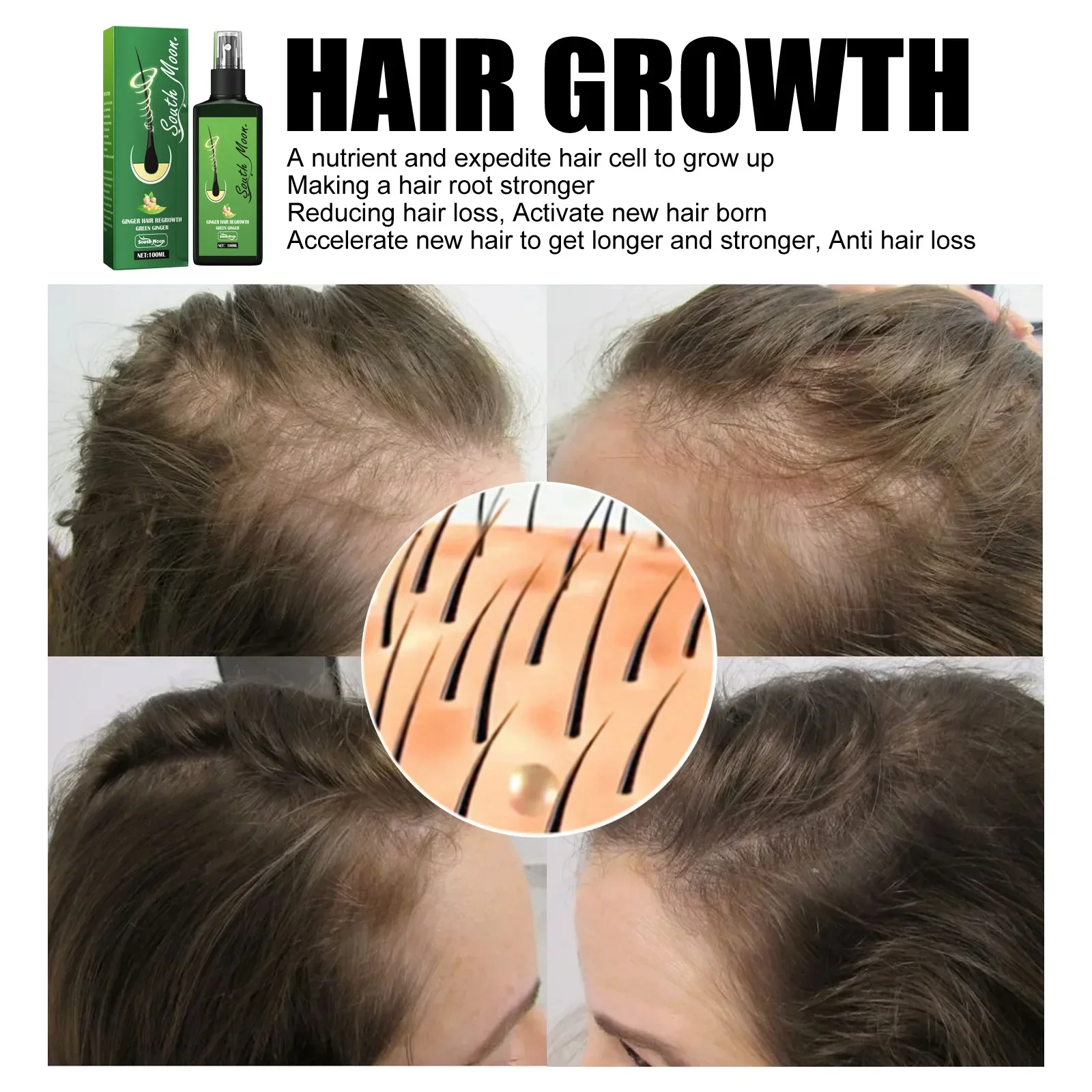 100ml South & Moon Hairs Lotion Spray for Hair Growth Longer Beard Anti Hair Loss Treatment Hair Growth Oil for Black Women