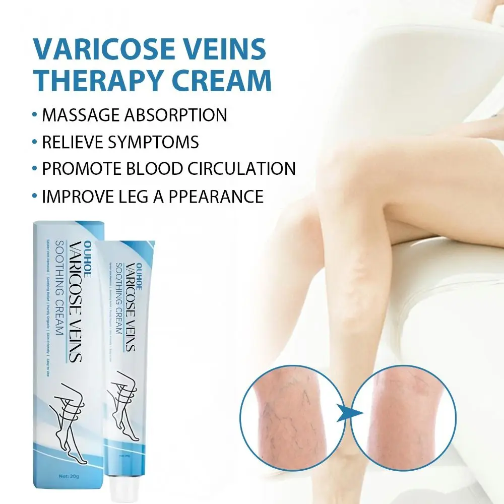 

2PCS Improve Blood Circulation Varicose Veins Treatment Cream Fast-Acting Reduce Leg Swelling Wellness Cream Soothes Tired