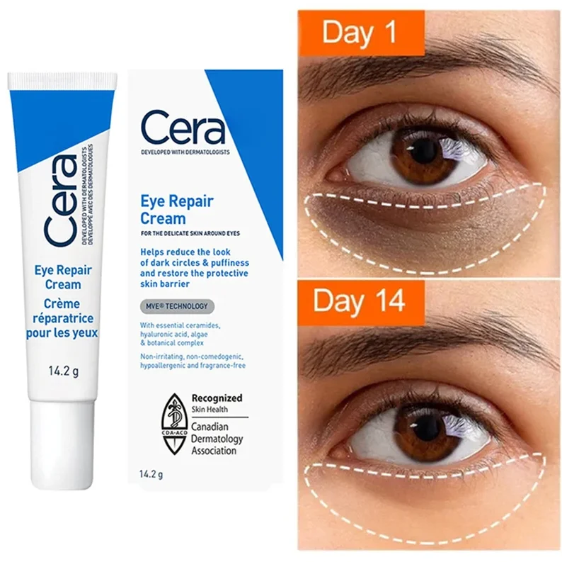 

Ceramide Eye Cream Repair Skin Barrier For Dark Circles Under Eyes Puffiness Moisturizing Whitening Anti-Fine Lines Eye Care