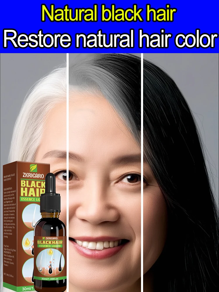 Wʜɪᴛᴇ ʜᴀɪʀ ᴋɪʟʟᴇʀ Remove ɢʀᴀʏ ʜᴀɪʀ ᴀɴᴅ ʀᴇsᴛᴏʀᴇ ɴᴀᴛᴜʀᴀʟ ᴄᴏʟᴏʀ ɪɴ 7 ᴅᴀʏs hair color restorer