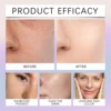 Vitamin Concentrated Serum Lightens Melanin And Brightens Skin Tone Vc Anti-oxidant Deep Repair Moisturizing Brightening Serum 6