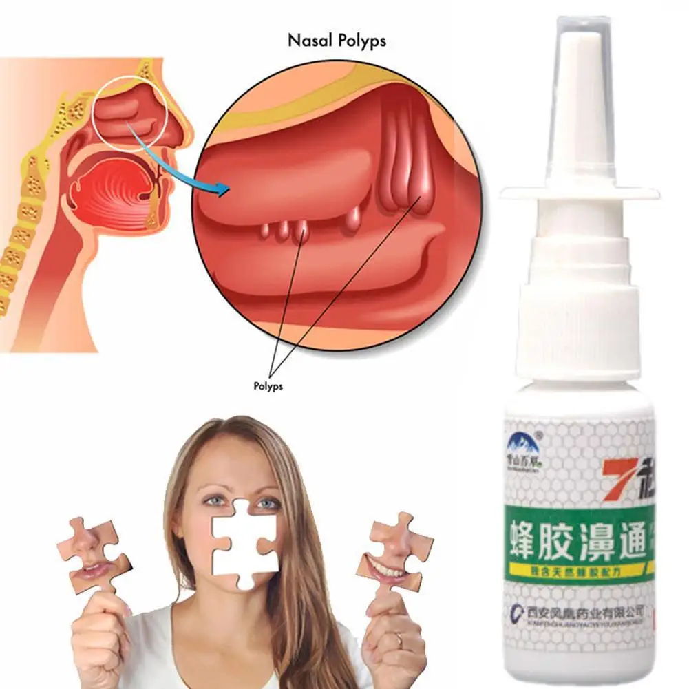 20ml Nose Spray To Relieve Nasal Discomfort Propolis Extract Nasal Drops Runny Itching Allergic Rhinitis Nose Health Care nose care spray nasal spray