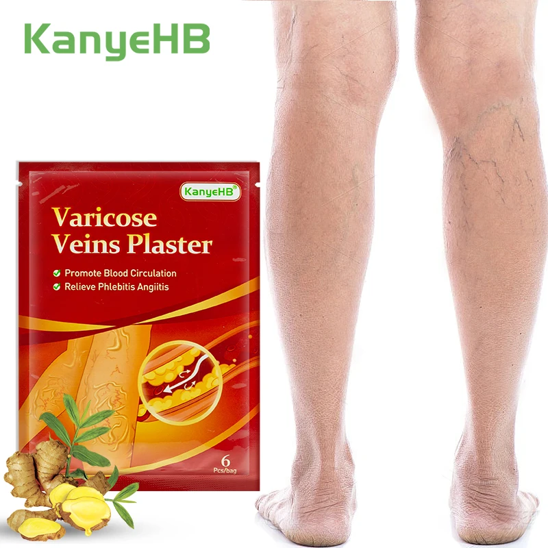 

6Pcs=1Bag Varicose Veins Patch Relieve Leg Vasculitis Phlebitis Angiitis Spider Vein Pain Herbal Medical Plaster Body Care W006
