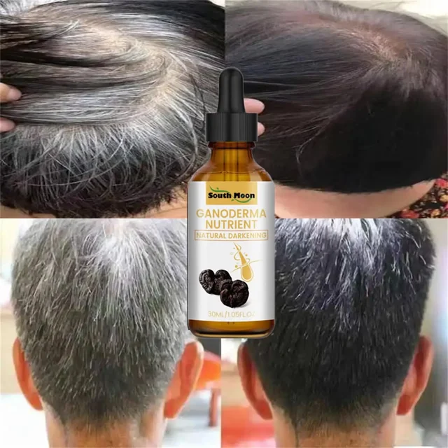 Anti Gray White Hair Serum Liquid White To Black Natural Color Repair Nourish Scalp Products Anti Loss Hairs Care For Men Women 2
