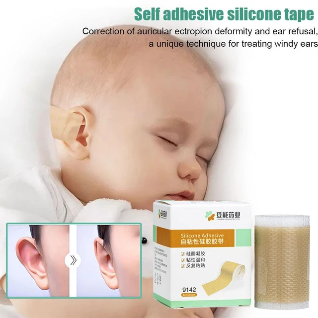 Baby Ear Corrector Silicone Ear Tape Baby Ear Aesthetic Correctors Kids  Infant Protruding Ear Patch Stickers Ear Support Tool for Babies 4 x 50cm