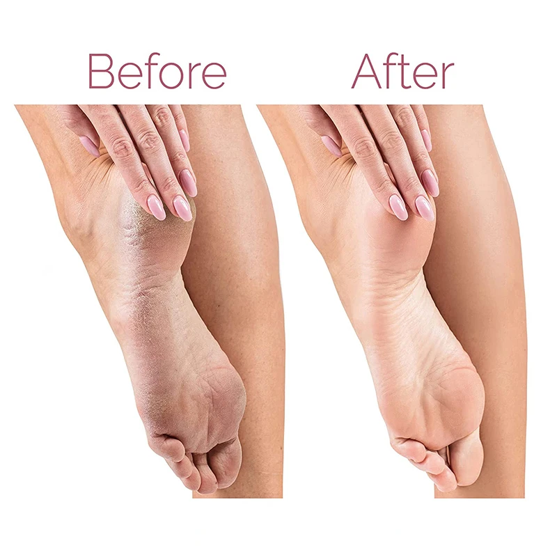 Electric Foot File electric foot grinder electric foot file electric foot callus remover for Heels Grinding Pedicure Tools Callus Remover USB Rechargeable Professional Foot Care Tool Dead Hard Skin