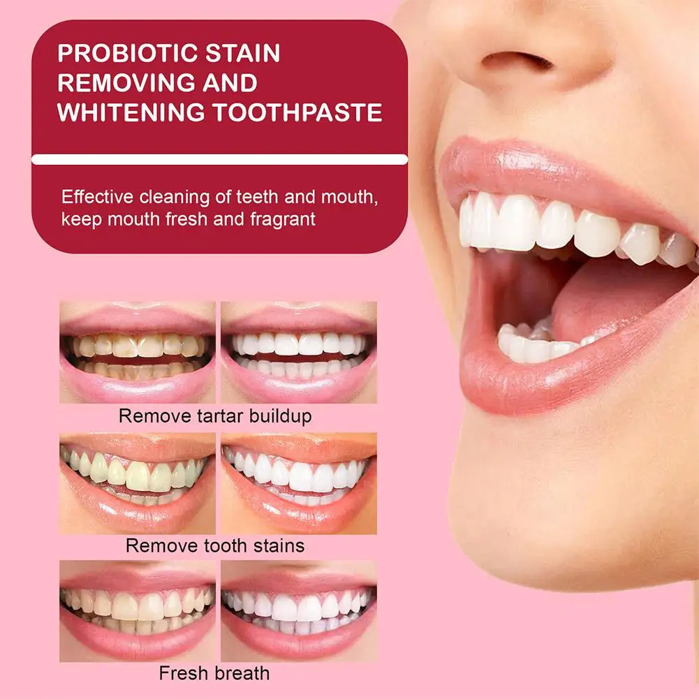 120g Probiotic Toothpaste SP-4 Tooth Decay Repair Remove Plaque Teeth Whitening Agent Fresh Breath Oral Care Product