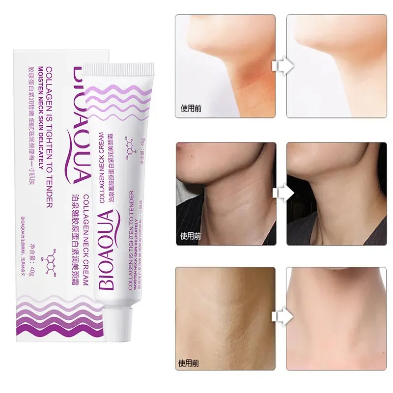 

40g Neck Cream Face and Neck Cream Neckline Cream Wrinkle Smooth Anti Aging Whitening