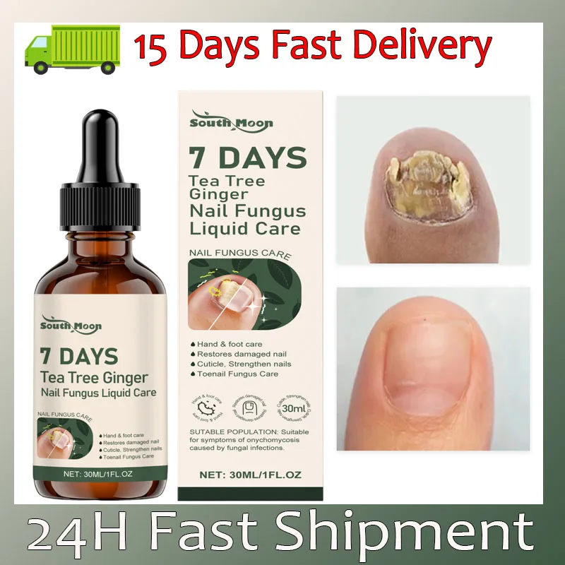 סרום נוזלי לטיפול בפטרת ציפורניים, תיקון ציפורניים, ג'ל להסרת פטרת ציפורניים, נגד דלקת פרוניכיה ואוניכומיקוזיס, טיפוח רגליים