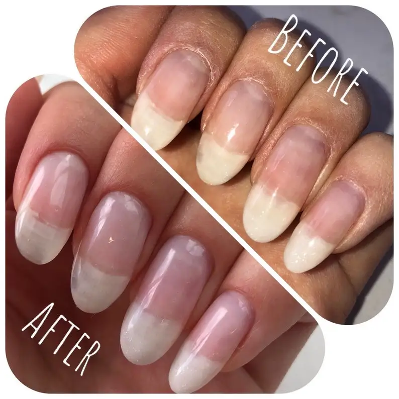 What Makes Your Nails Grow Faster visitchile.cl