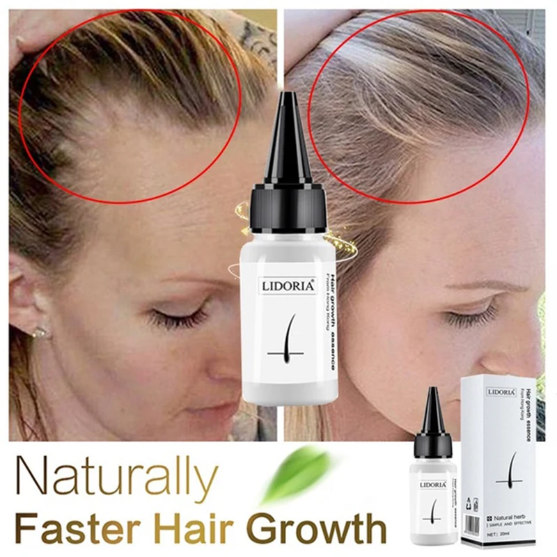 

20ml Fast Hair Growth Serum Anti Preventing Hair Lose Liquid Damaged Hair Repair Treatment Eyelash Eyebrow Growing Thick Care