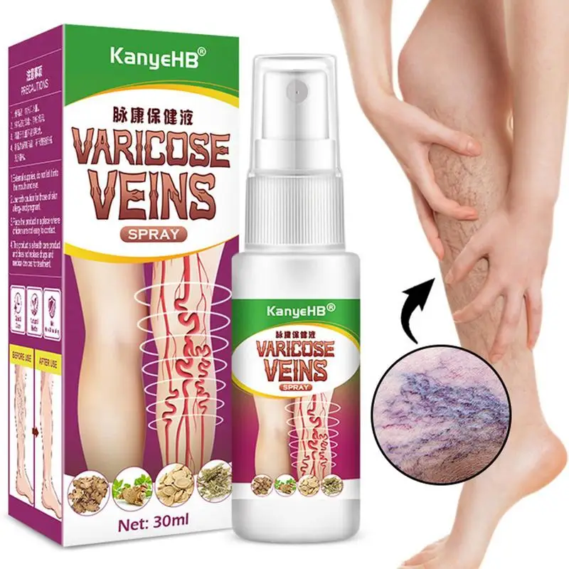 

30ml Varicose Vein Spray Herbal Angiitis Remedy Spray Relief Veins Hurt Phlebitis Legs Varicose Vein Spray For Legs Care
