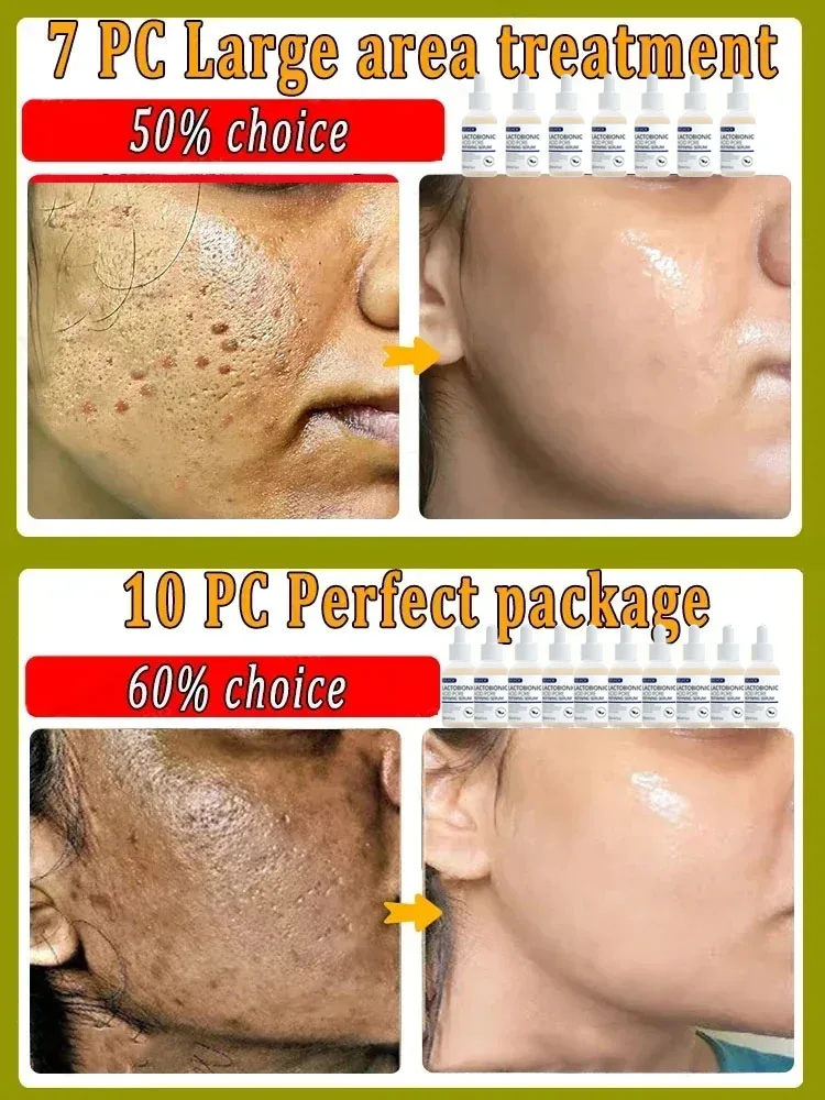 Lactobionic Acid Pore Shrink Face Serum Hyaluronic Acid Moisturizing Nourishing Essence Firming Brighten Beauty Korean Cosmetics 6