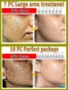 Lactobionic Acid Pore Shrink Face Serum Hyaluronic Acid Moisturizing Nourishing Essence Firming Brighten Beauty Korean Cosmetics 6