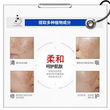 BIOAQUA Acne Removing Cream Acne Treatment Blackhead Removal Cream skincare Shrink Pores Anti-acne Creams Facial Skin Care - Thumbnail 2