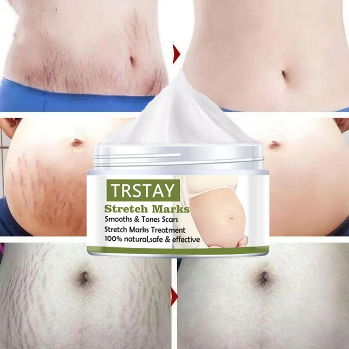 Pregnant Women's Belly Line Cream For Preventing Postpartum Pregnancy Lines Repair Cream 3