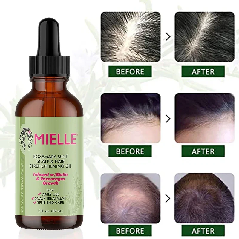 Olio essenziale per la crescita dei capelli rosmarino menta olio rinforzante per capelli trattamento Dry Mielle Organics Split Ends olio essenziale per capelli