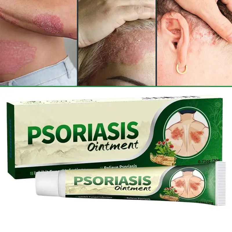 Anti-Itch Body Cream Ointment Acne Pimples Smooth Skin Anti Itching Prevent Pores Clogging Care Antipruritic Soothing Cream