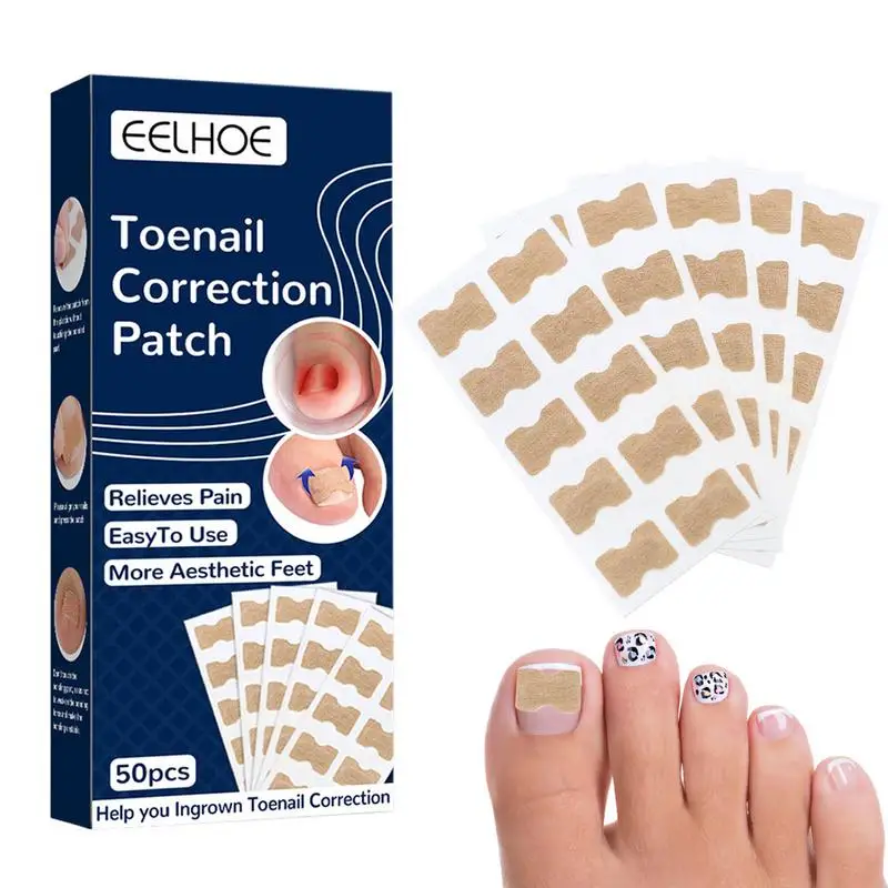

Ingrown Toenail Correction Stickers Toenail Corrector Patch Foot Care Kit Glue-Free Nail Corrector Patch Pedicure Tools
