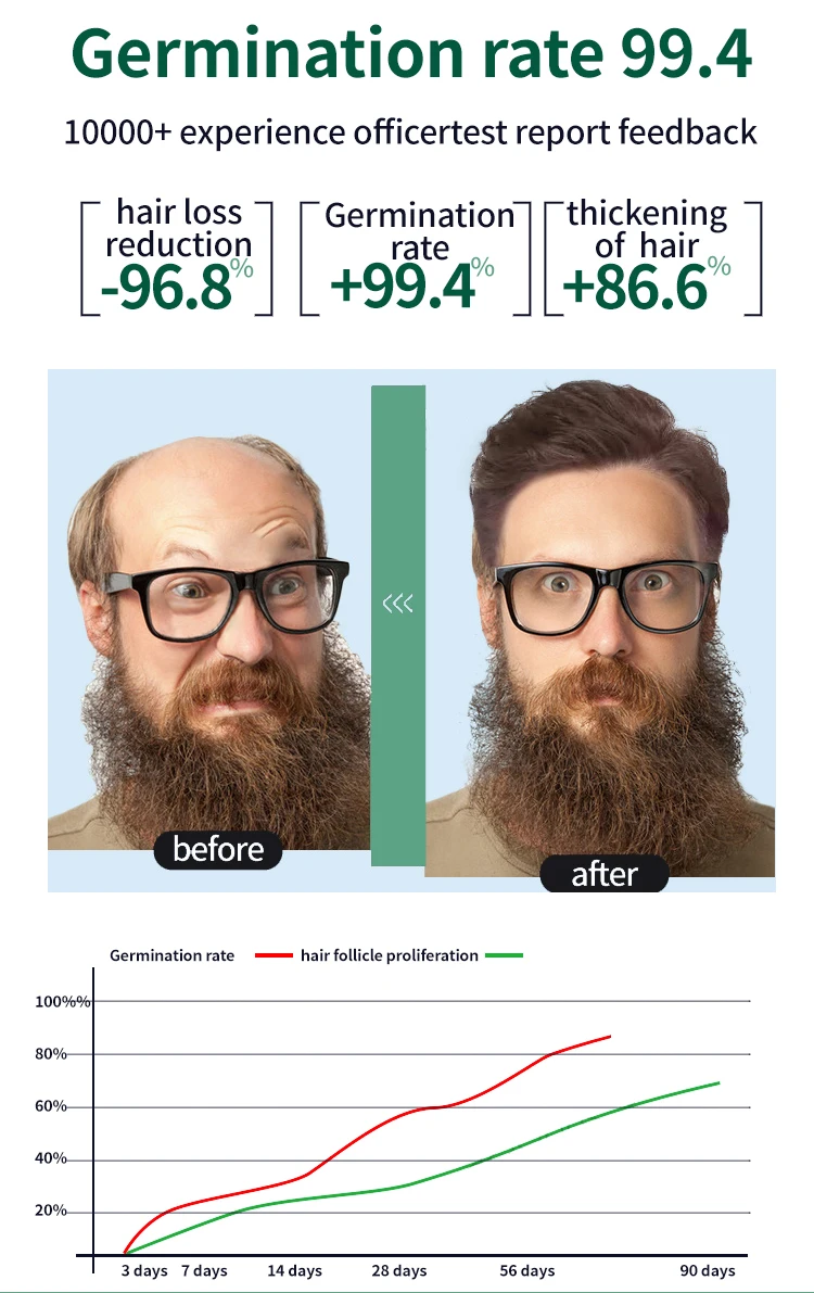 Buy Hair Follicle Repair Hair Growth Plant Essence Oil Rapid AntiHair Loss Regeneration Sssence
