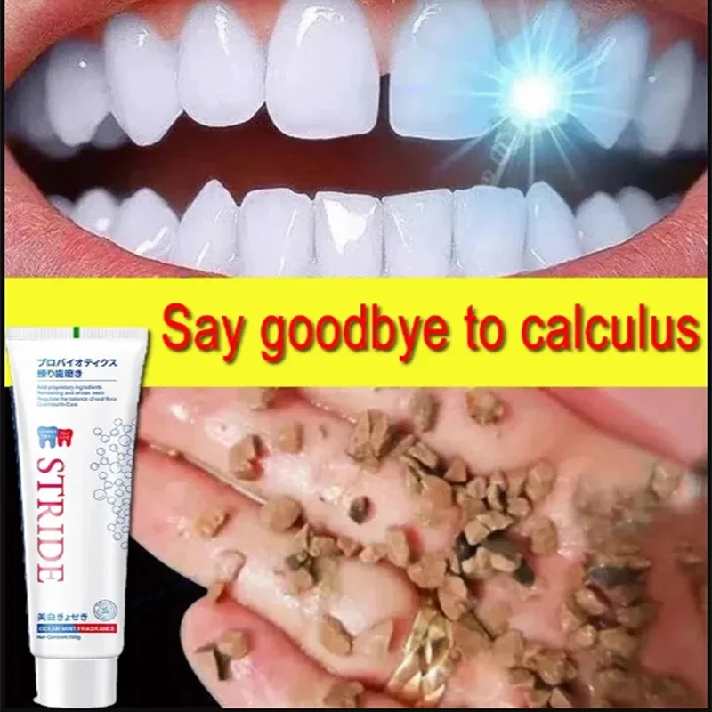 

Dental Calculus Remover Whitening Teeth Toothpaste Brightening Preventing Periodontitis Removal Bad Breath Dental Clean Care