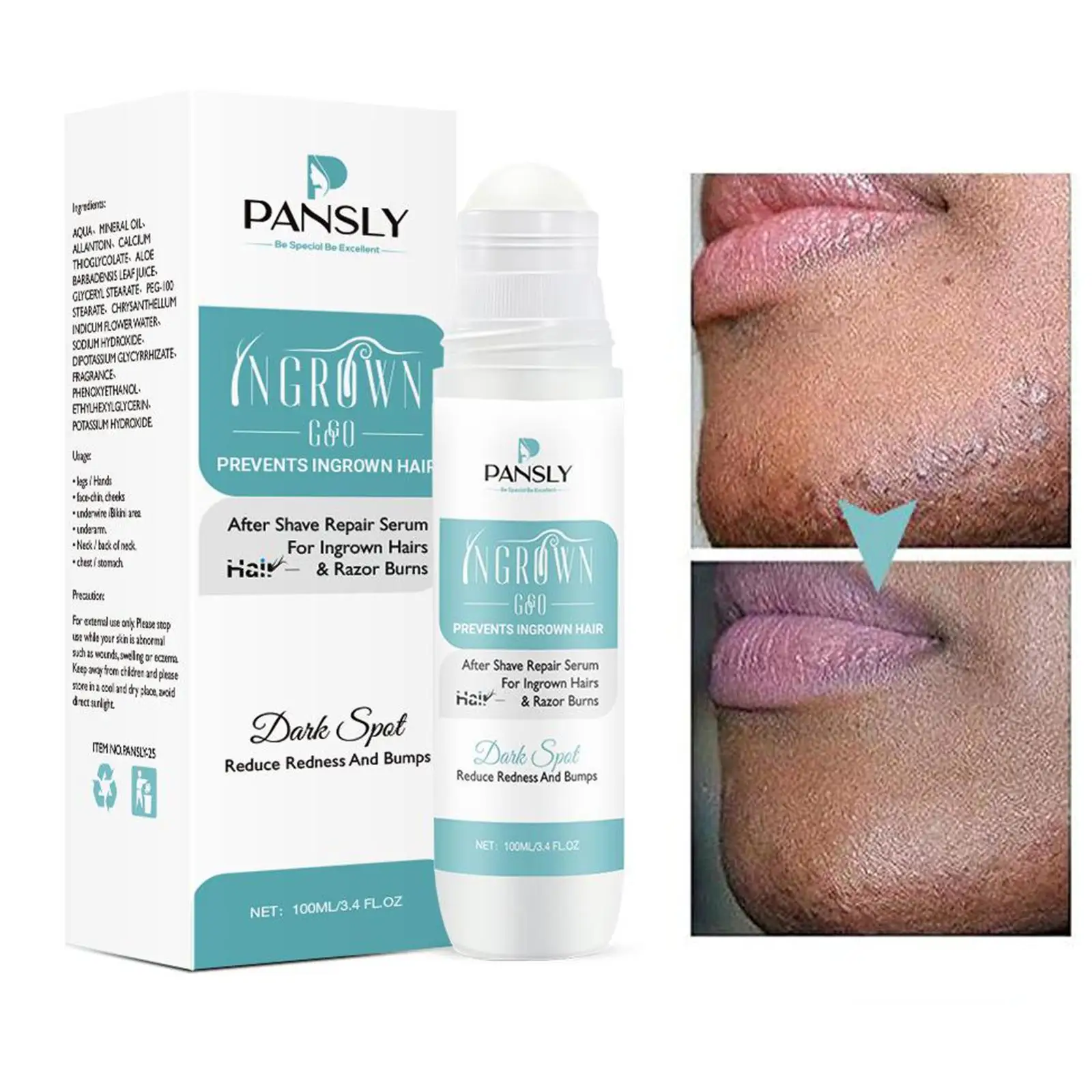 100ml Aftershave Serum for Men Women & Ingrown Hairs Moisturizer Remover after Hair Removal Skin Ingrown Hair Solution