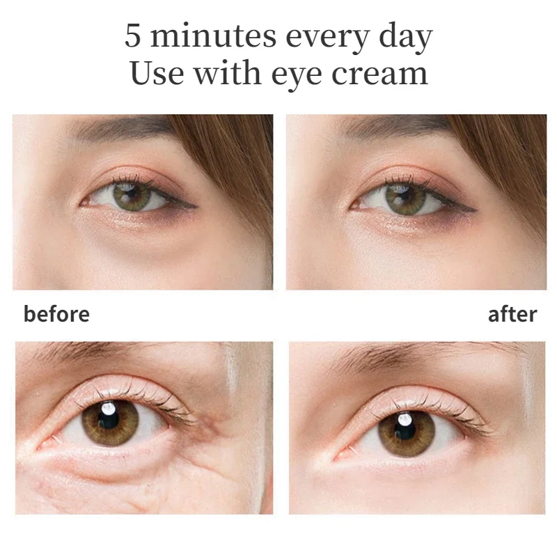 Thermal Eye Beauty Devices Fade Black Circle Anti Wrinkle Beauty Pen Eye Cream Introduction 42 &deg; Vibration Massage Tools eye massager