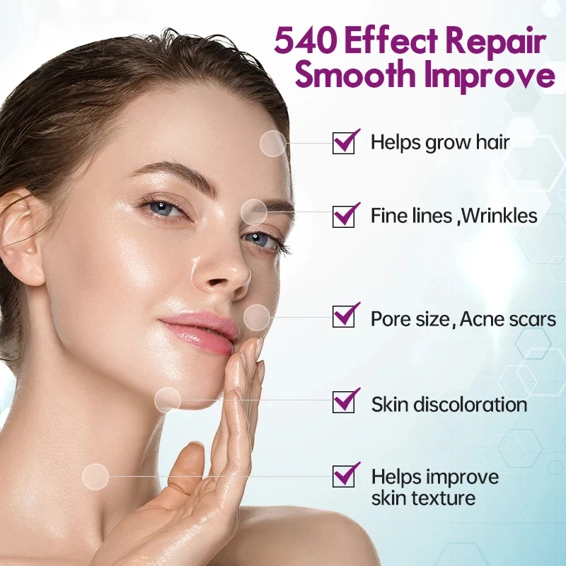 DRS540 Derma Face Roller 540 Pins Medical Grade Microneedling Dermaroller Beauty Skincare Tool with CE and RoHs Certificate
