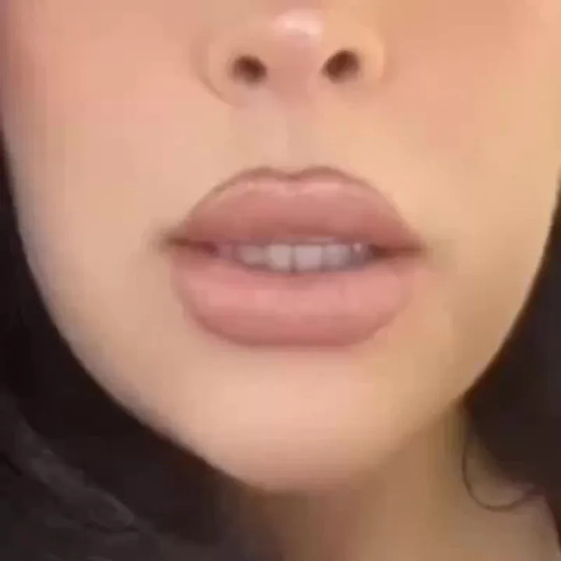 Slide image ca5f4f7fb7824bb0bd85a449708708d9