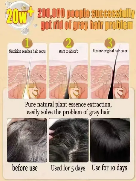Tueur de cheveux blancs &eacute;limine les cheveux blancs en 7 jours et restaure la couleur naturelle des