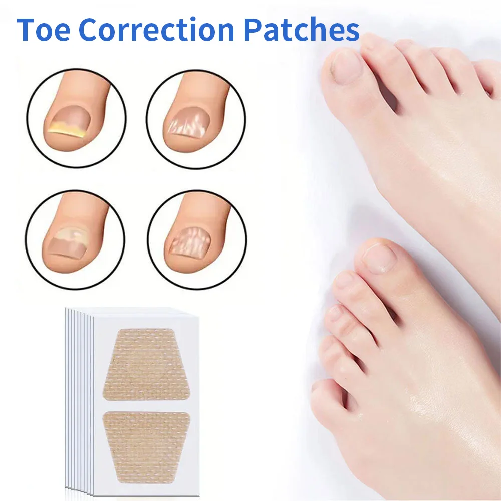 Toenail Fungus Patch Nail Repair Patches Nail Ingrown Correction Stickers for Discolored or Damaged Nails Sticker Toenail Care