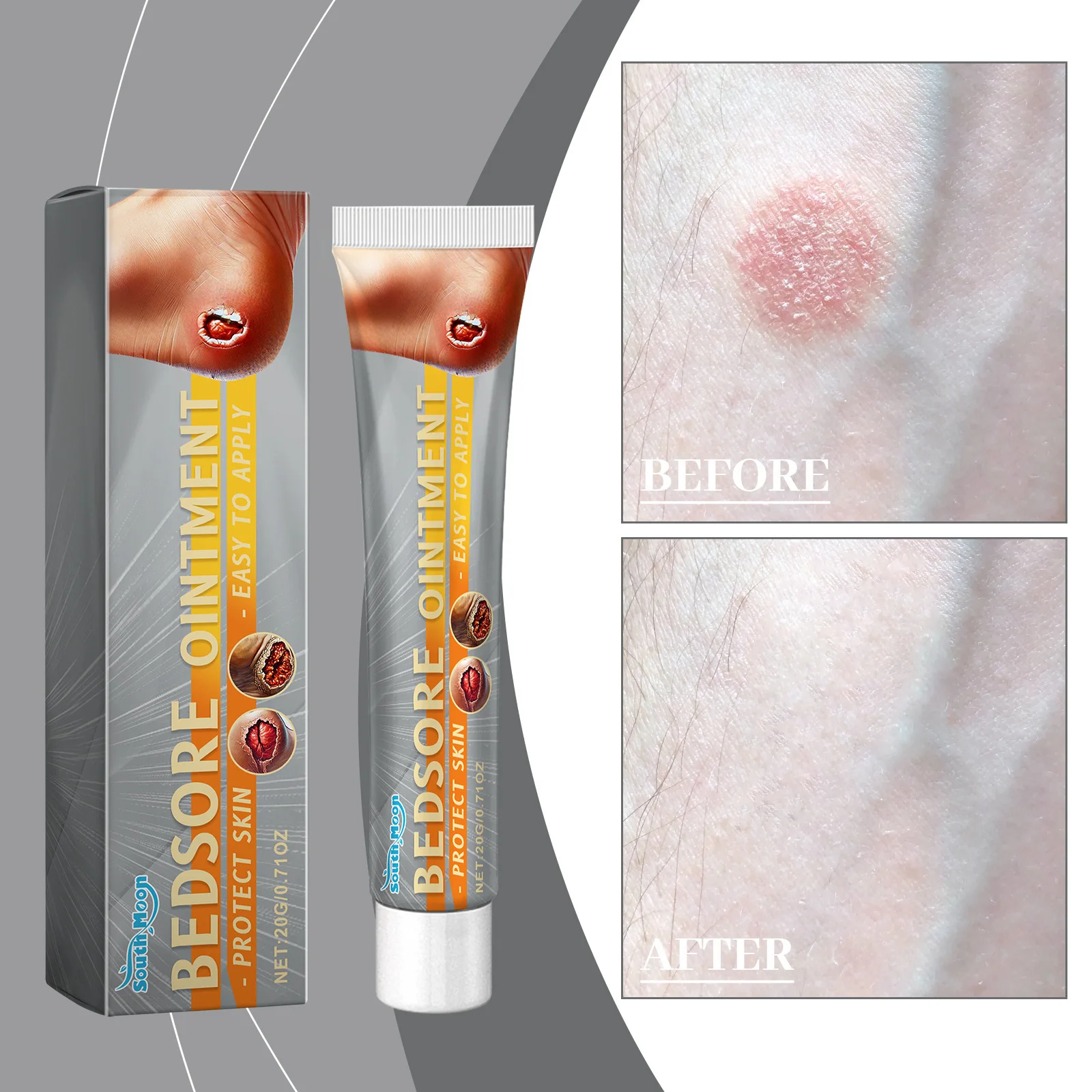 South Moon Bedsores Wound Healing Ointment Removal Rot Myogenic Pressure Sores Ulcer Festering Anti Infection Repair Skin Care