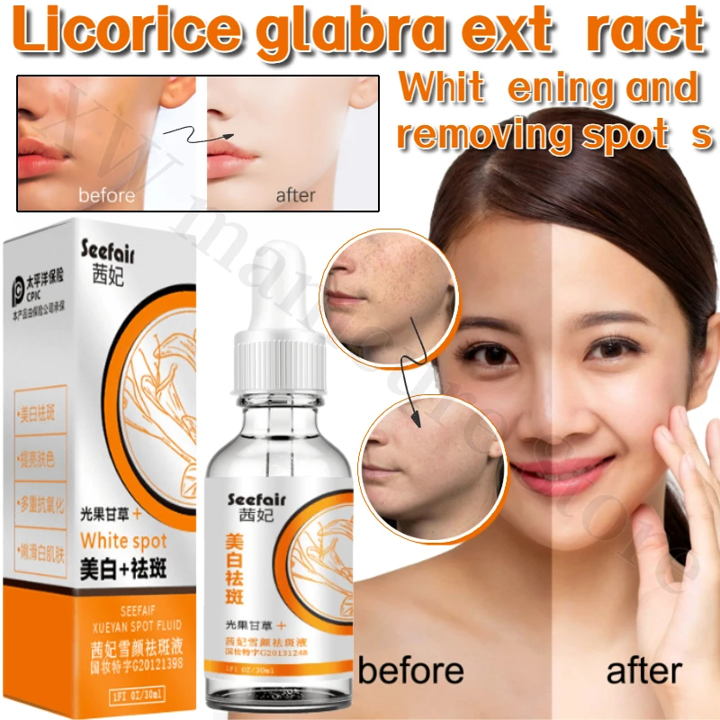 

Anti-freckle Essence Repairs Pigmentation Licorice Whitening Body Removes Dark Spots and Chloasma Facial Whitening Serum 30ml